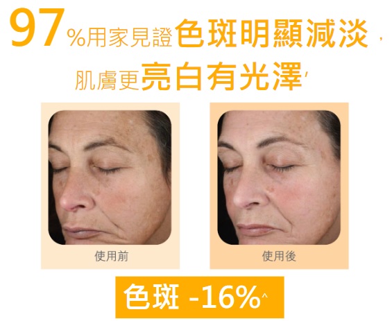 NeoStrata醫學淨白精華素_NeoStrata_Enlighten_Illuminating_serum_去斑_美白_美白產品推介_去黑色素_醫學美白_色斑_淡斑_荷爾蒙斑_去荷爾蒙斑_去荷爾蒙斑產品推介_去斑產品推介_gratus_用家分享