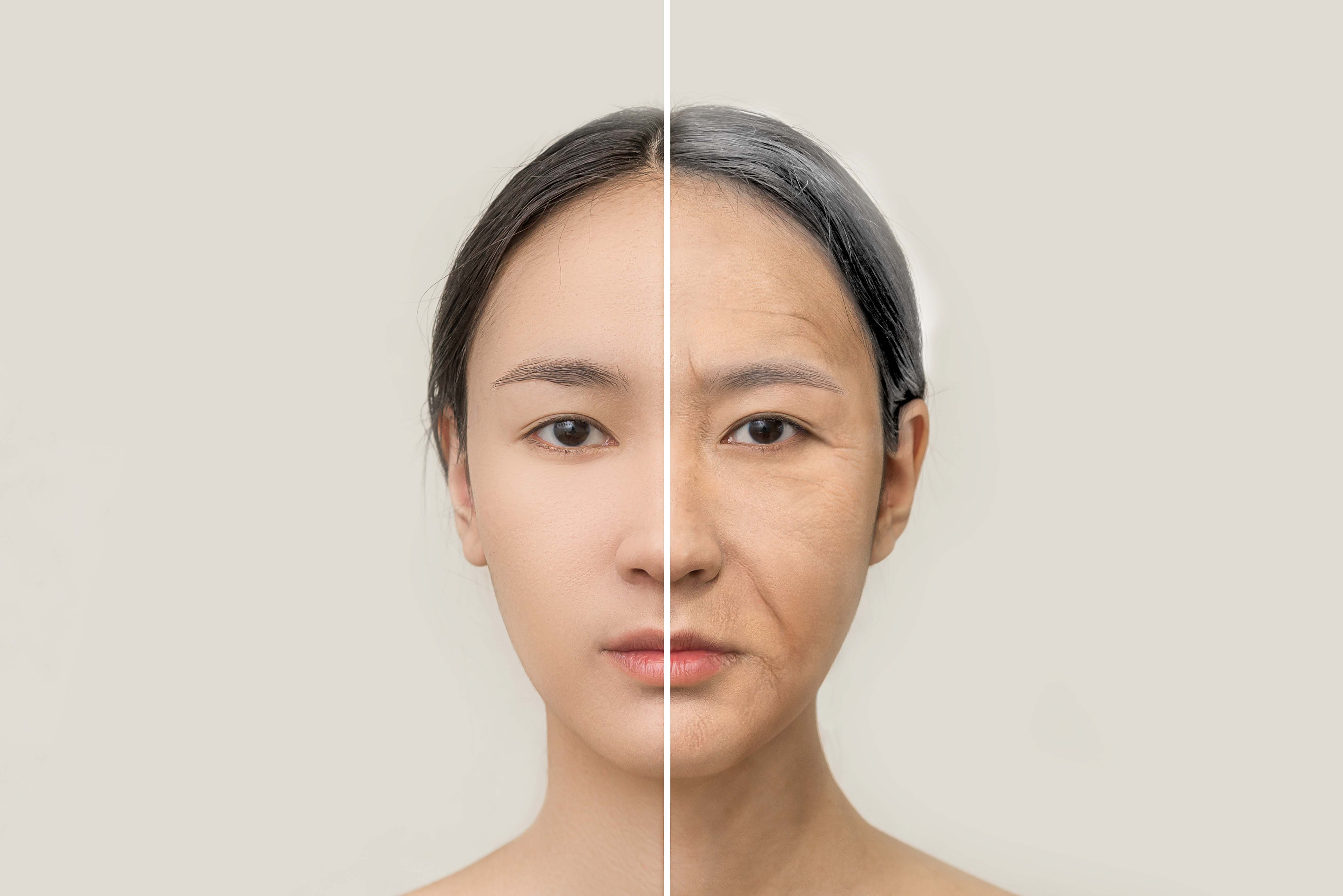 皮膚提早由20歲步入衰老，出現細紋、毛孔粗大、皮膚乾燥症狀"