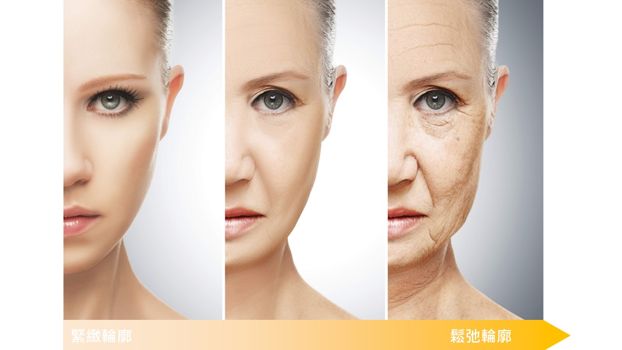 眼睛最易暴露年紀，眼紋、眼皮下垂及眼袋造成「人未老眼先老」的現象