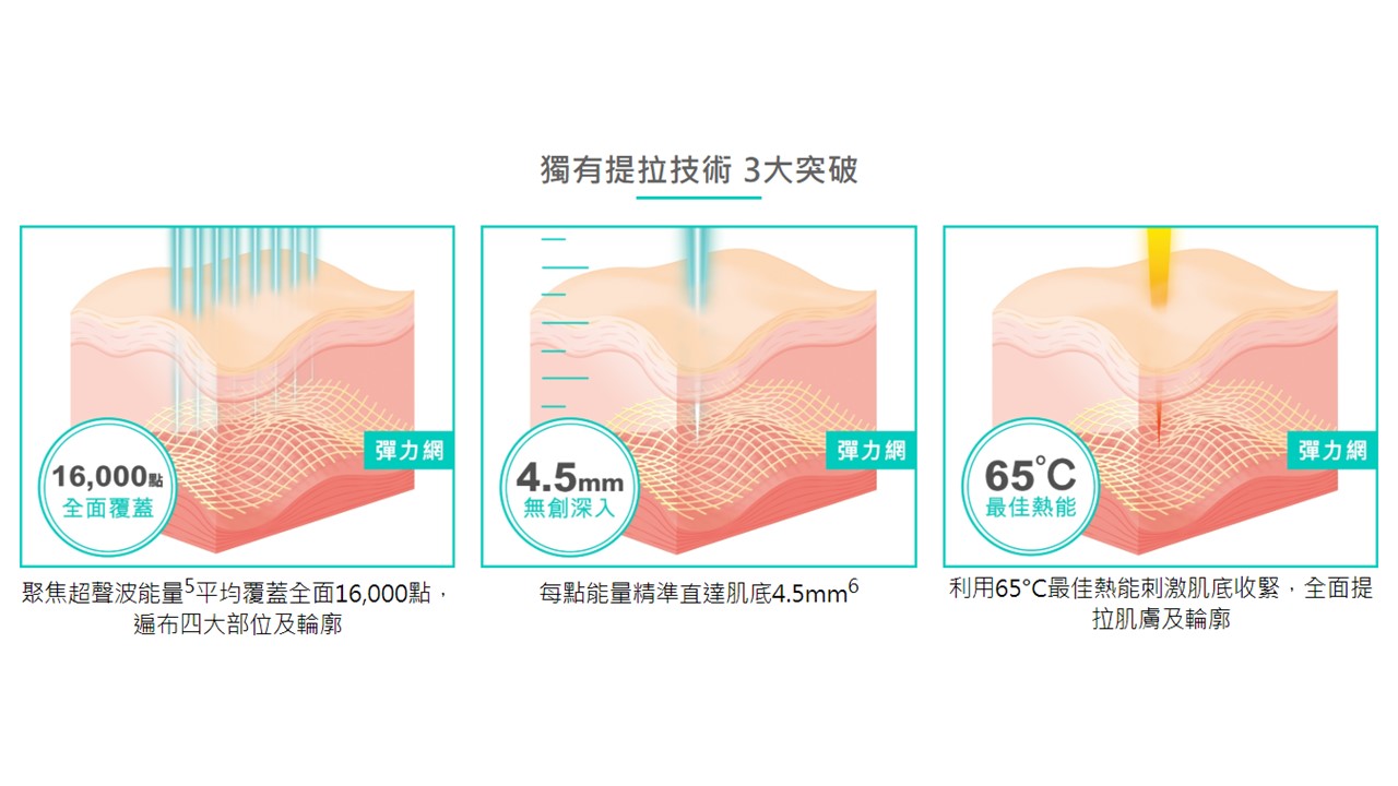 Ultherapy彈力網提位療程技術3大優勢