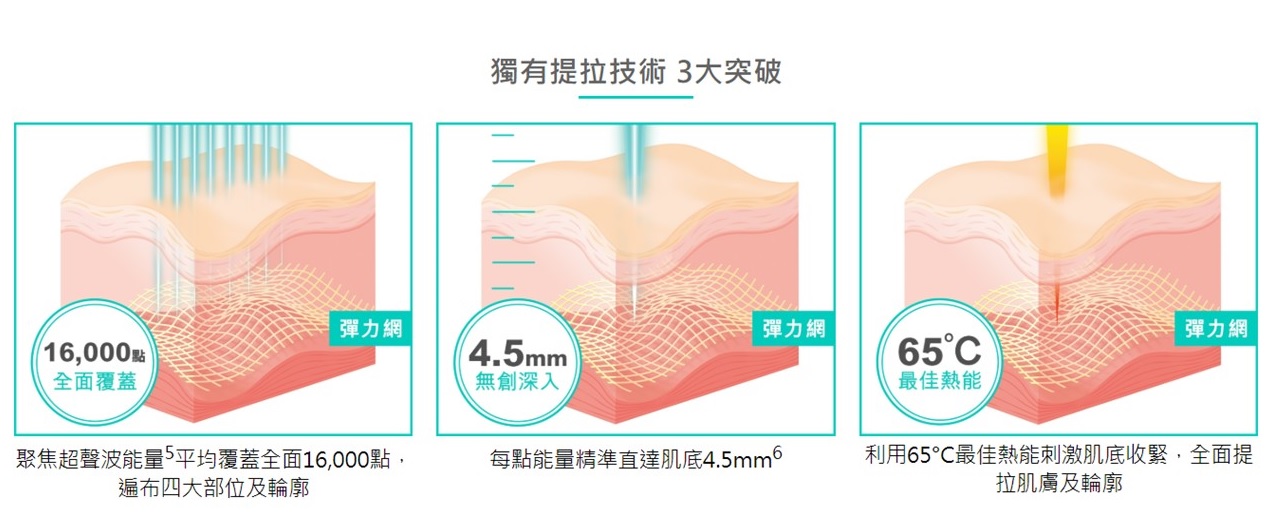 1/ Ultherapy聚焦超聲波能量平均覆蓋全面16,000點，重點提拉四大部位及輪廓，去眼紋、雙下巴、去頸紋、V面提升。  2/ Ultherapy所打出的每點能量精準直達肌底4.5mm  3/ Ultherapy利用65°C最佳熱能刺激肌底收緊，全面提拉肌膚及輪廓提升