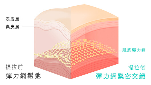 「肌底彈力網」的位置"