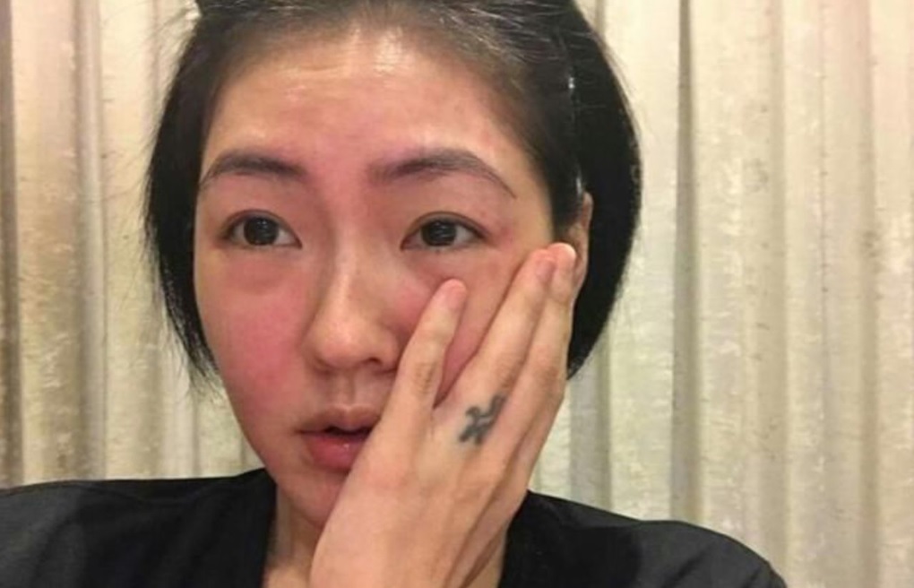 即使不屬敏感皮膚，都很容易會誘發皮膚過敏_Heliocare水感補濕防曬乳SPF 50+_防曬霜_防曬霜推介_好用防曬霜_防UVA/UVB/藍光/紅外線防曬霜_夏日防曬_清爽防曬_滋潤防曬霜_美白防曬_滋潤防曬_口罩肌防曬霜推介